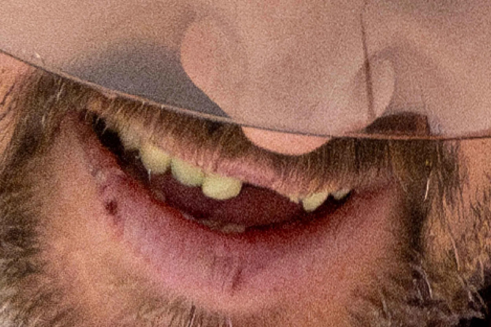 A close-up of Ovechkin's chipped tooth