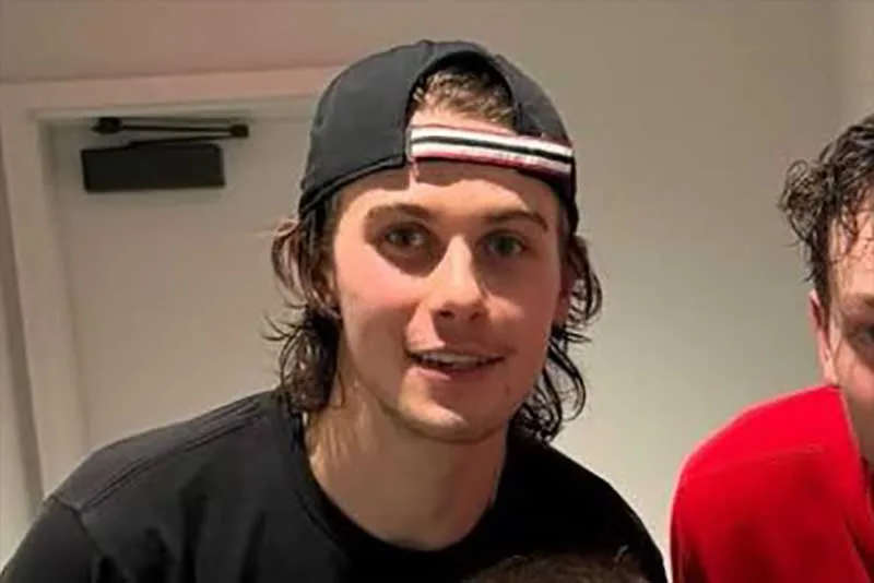 Jack Hughes' repaired smile following the Olympics